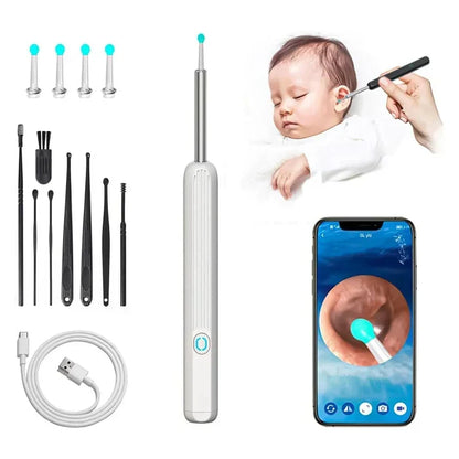 1080P HD Smart Earwax Removal Kit – Safe & Easy Cleaning